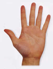 Palmistry Palm Reading - The Fire Hand